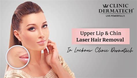 Upper Lip And Chin Laser Hair Removal In Lucknow Clinic Dermatech