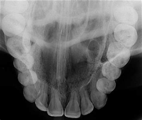 Radiografia Oclusal Diagna Araguari