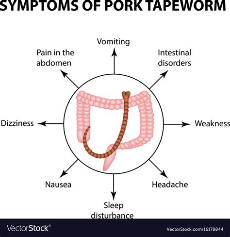 Symptoms Of Pork Tapeworm Infographics Royalty Free Vector