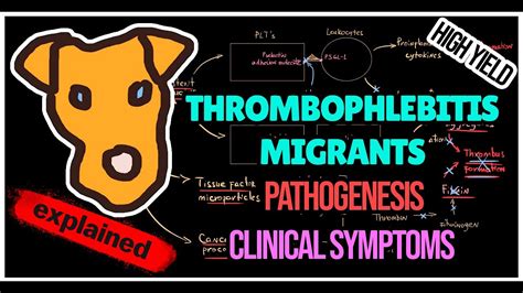 Thrombophlebitis Migrants Trousseau Syndrome Pathogenesis Symptoms