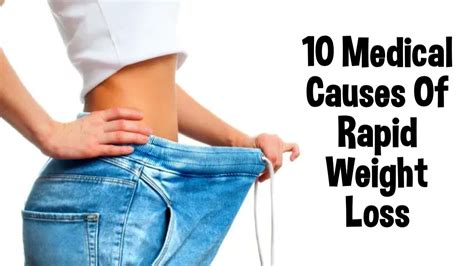 10 medical causes of rapid weight loss youtube