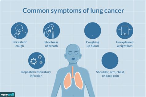 Lung Cancer Signs Symptoms And Complications 22440 Hot Sex Picture