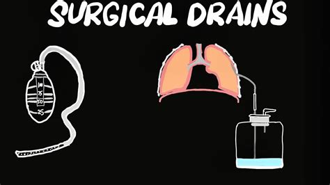 Surgical Drains Types Classification Uses Indicationscomplications