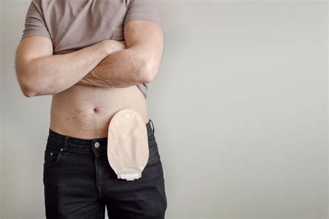 What Is The Difference Between An Ostomy And A Colostomy