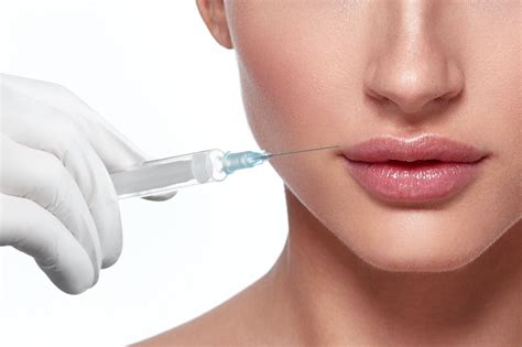 Dissolving Lip Fillers Natural And Injection Method Explained