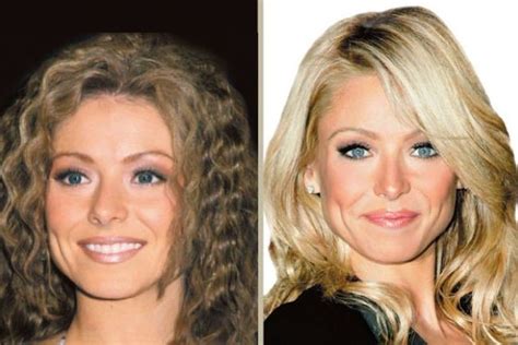 Kelly Ripa Before And After Plastic Surgery 9 Celebrity Plastic