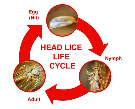 How To Get Rid Of Lice Faqs Lice Clinics Of Texas