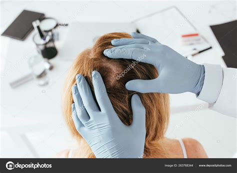 Overhead View Dermatologist Blue Latex Gloves Examining Hair Patient