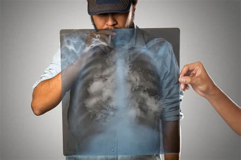4 Masalah Paru Paru Yang Mengintai Perokok Aktif Hello Sehat