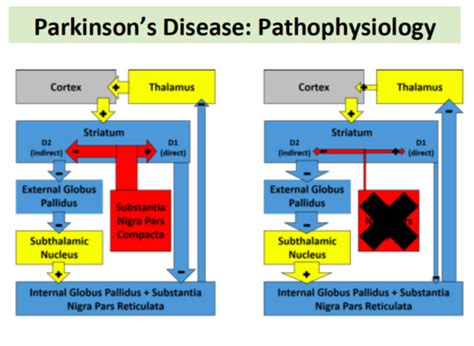 Parkinsons Disease Flashcards Quizlet