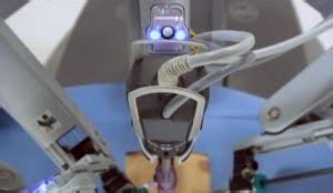 Chirurgie mini invasive et robotique les news HYSTÉRECTOMIE par