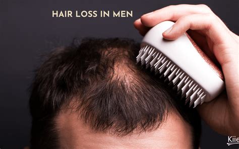 Hair Loss In Men Why It Happens And What You Can Do About It Kiierr