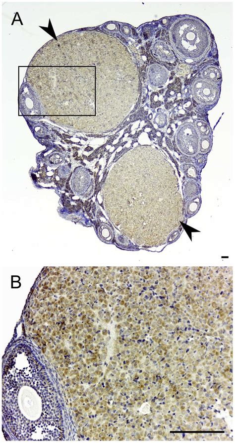 TSPO is expressed in the active corpus luteum. Immunohistochemical ...
