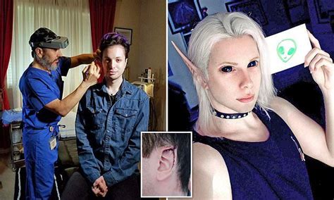 Man Spends 60000 Transforming Himself Into Human Elf Chin