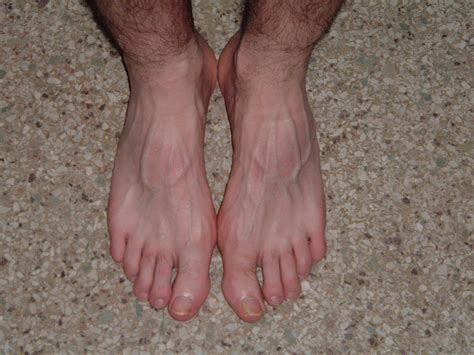 All About Feet Picture Gallery