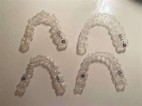 First Tray Vs Now Tray 24 6 Months Rinvisalign