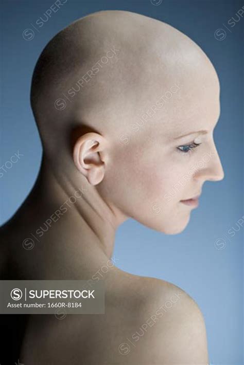 Profile Of A Bald Young Woman Thinking Stock Photo 1660r 8184 Superstock