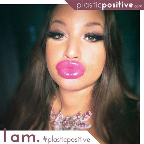 Thick Fake Plastic Bimbo Lips Pics Xhamster Sexiz Pix