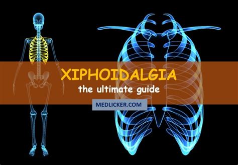 Xiphoid Process Pain Xiphoidalgia The Ultimate Guide