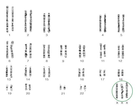 Picture Of Sex Chromosomes Telegraph