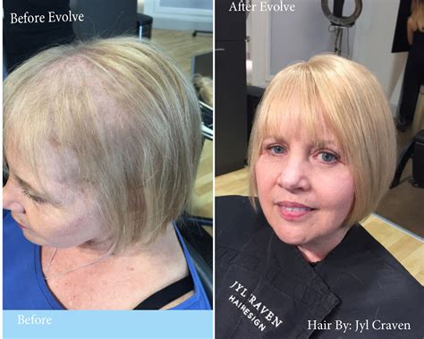 Tired Of Fine Or Thinning Hair We Have The Solution Jyl