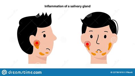 Salivary Gland Concept Stock Vector Illustration Of Structure 227361610