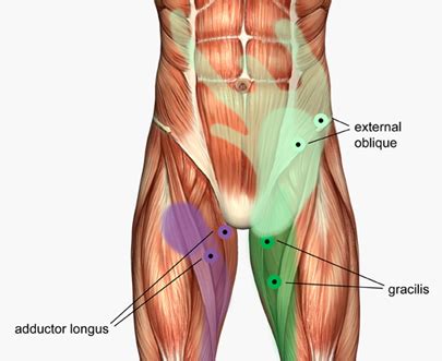 The muscles in the medial compartment of the thigh are collectively known as the hip adductors. Groin Strain (Groin Muscle Pain) - Anatomy, Symptoms ...