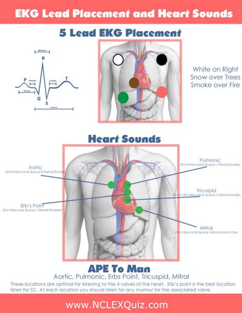 5 Lead Ekg Placement And Heart Sounds Nclex Quiz