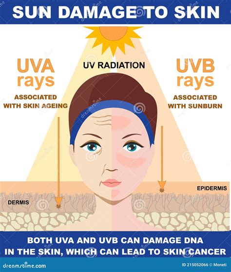 The Difference Of Radiation 2 Types In Sunlight Which Is Harmful To The