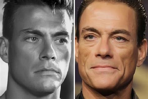 Jean Claude Van Damme Before And After Plastic Surgery