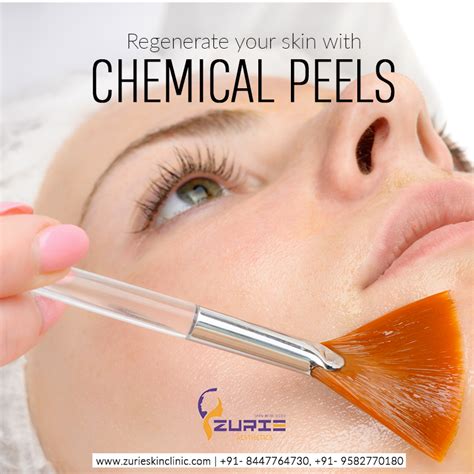 Chemical Peel Is A Popular And Effective Aesthetic Procedure That Can