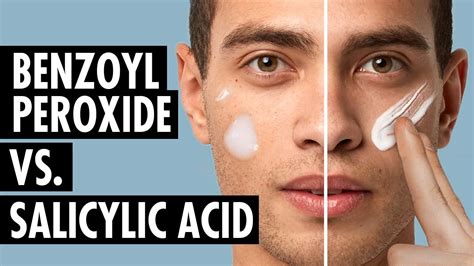 Benzoyl Peroxide Vs Salicylic Acid Best Ingredients To Fight Acne