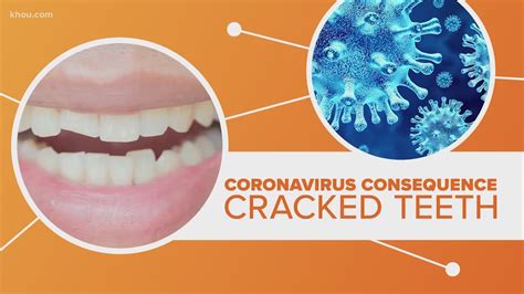 Covid 19 And Cracked Teeth