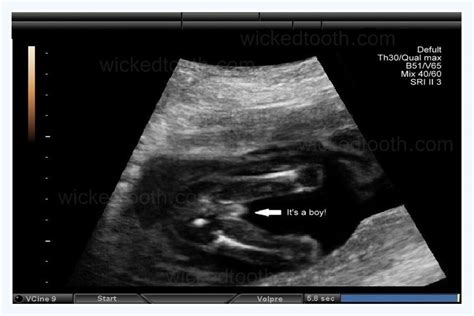 How To Make A Fake Baby Ultrasound Dbabyzi