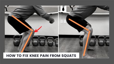 How To Fix Knee Pain From Squats Solving Pain With Strength