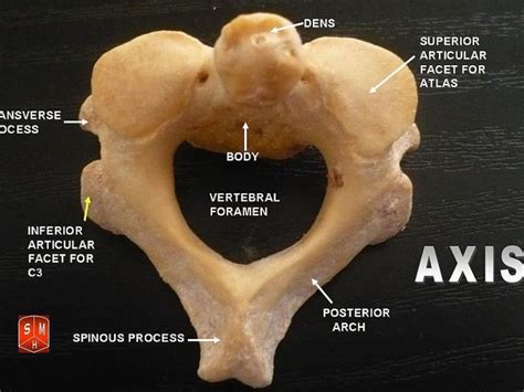 Difference Between Typical And Atypical Vertebrae Compare The