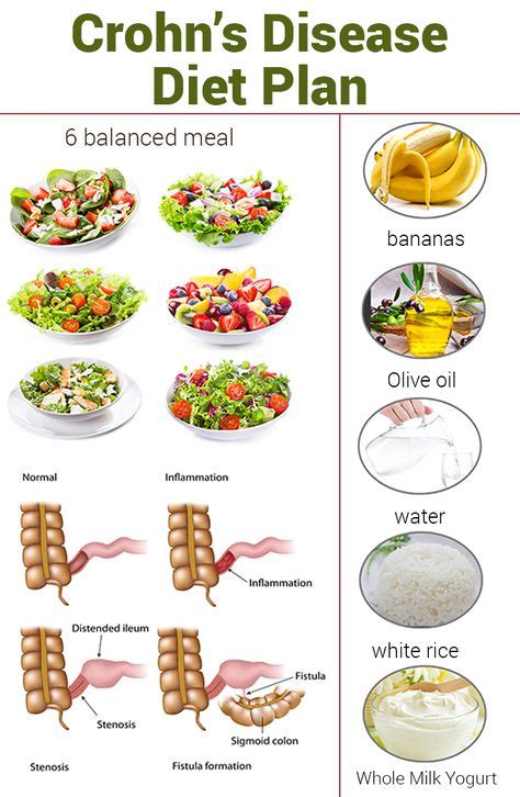 10 Crohns Colitis Diet Ideas In 2020 Crohns Colitis Diet Crohns Disease Diet