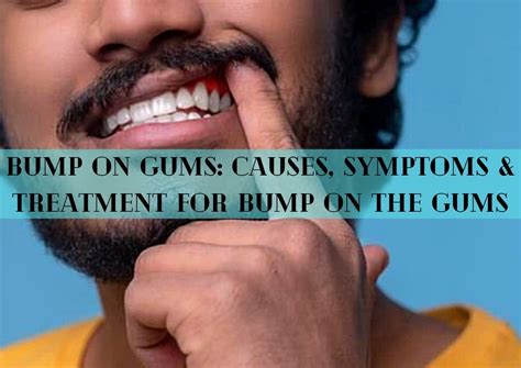 Bump On Gums Causes Symptoms And Treatment For Bump On The Gums