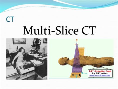 Ppt Multi Slice Ct Powerpoint Presentation Free Download Id5573730
