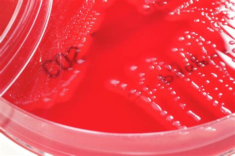 Streptococcus Pyogenes Culture Photograph By Daniela Beckmann Science
