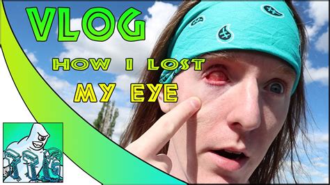 Vlog How I Lost My Eye Youtube