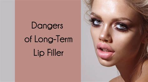 Dangers Of Long Term Lip Filler Dr Anna Medical Aesthetics