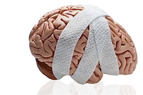 Teenage Concussion Linked To Later Risk Of Ms