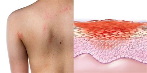 10 Common Causes Of Itchy Red Bumps And Skin Rashes Кожа Человек