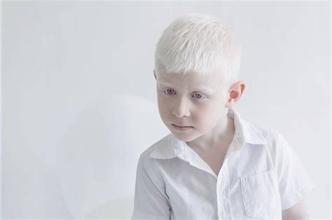 Photographer Captures The Hypnotizing Beauty Of Albino People Israel C