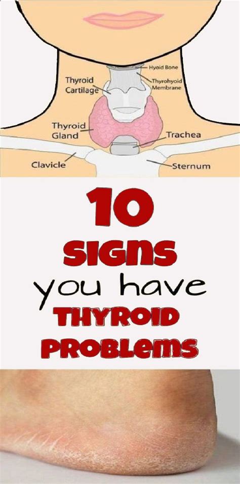 10 Signs You Have A Thyroid Problem And 10 Ways To Deal With It West