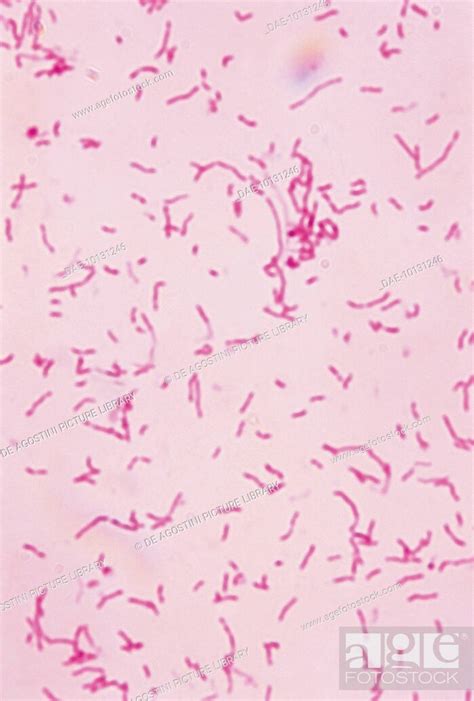 Vibrio Cholerae Microscope
