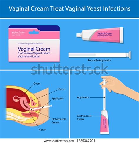 Vaginal Yeast Infections Treatment Applicator Symptoms Stock Vector