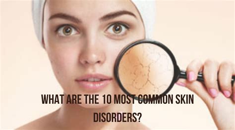 What Are The 10 Most Common Skin Disorders Dermatrichs Clinic Kanpur