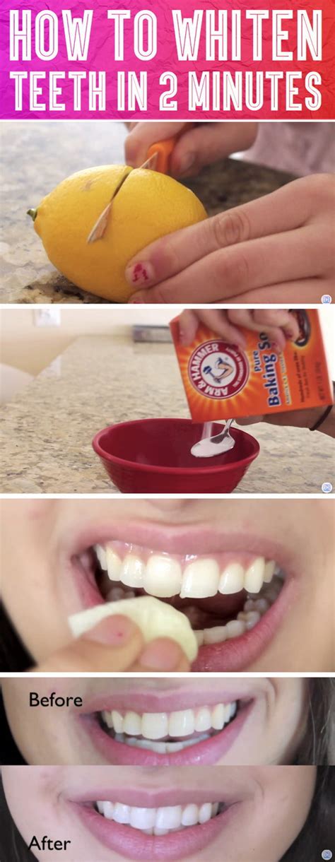 Learn more about removing teeth stains. 15 Natural Ways to Whiten Your Teeth: Homemade Teeth ...